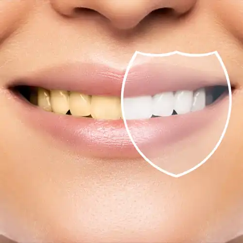 beautiful female smile teeth whitening hygiene result after treatment professional dental clinic copy